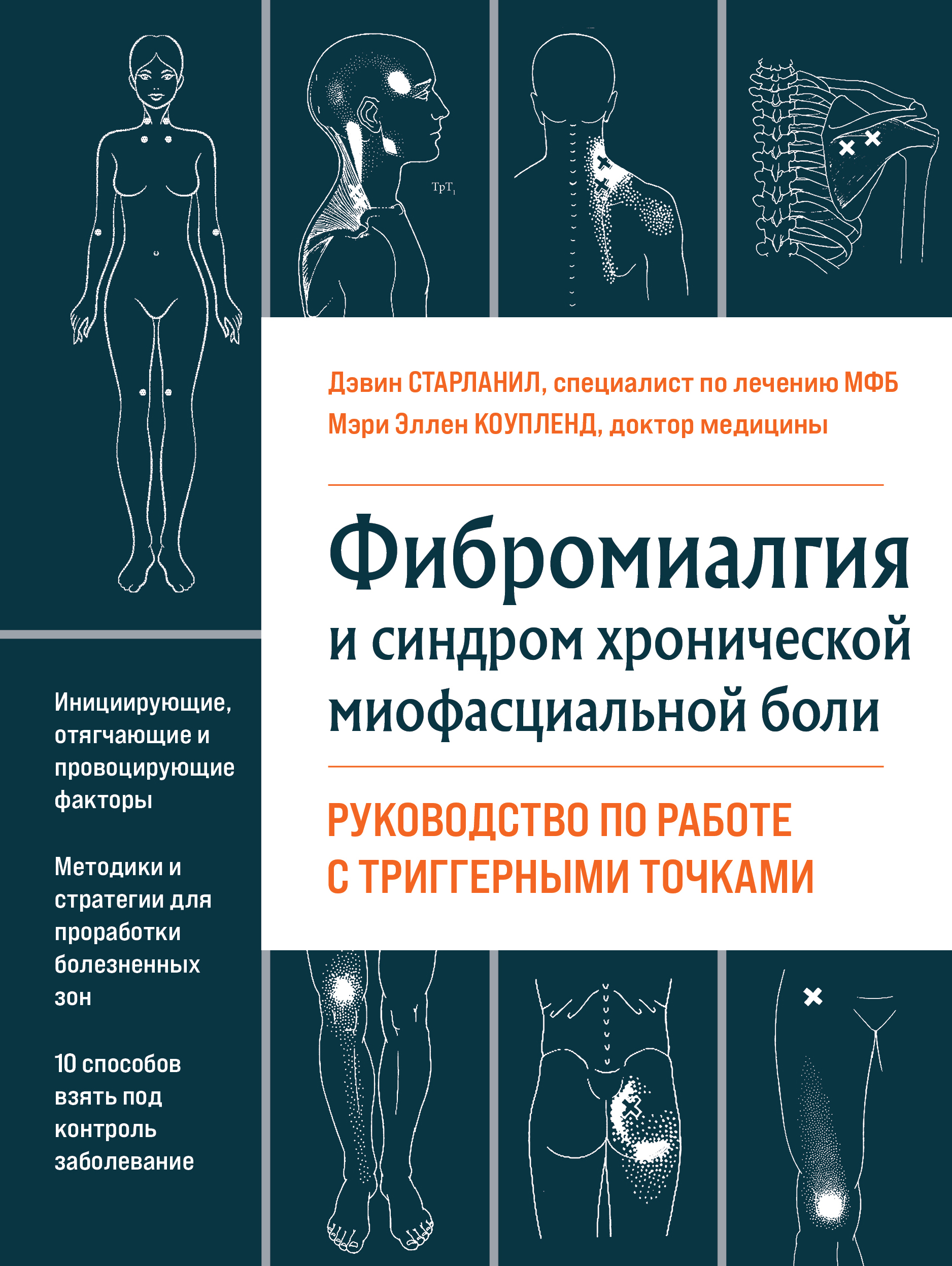 Фибромиалгия и синдром хронической миофасциальной боли. Руководство по работе с триггерными точками
Фибромиалгия и синдром хронической миофасциальной боли. Руководство по работе с триггерными точками